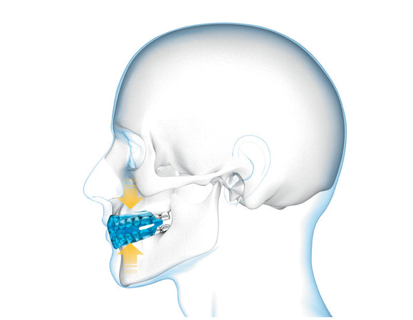 Tandbeskytter - Shock Doctor - 'Double Braces' - SR - Blå